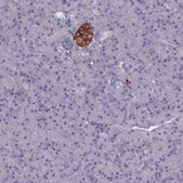 Anti-GAD2 antibody produced in rabbit Prestige Antibodies® Powered by Atlas Antibodies, affinity isolated antibody, buffered aqueous glycerol solution