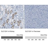 Anti-SLC12A1 antibody produced in rabbit Prestige Antibodies® Powered by Atlas Antibodies, affinity isolated antibody, buffered aqueous glycerol solution