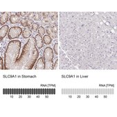 Anti-SLC9A1 antibody produced in rabbit Prestige Antibodies® Powered by Atlas Antibodies, affinity isolated antibody, buffered aqueous glycerol solution