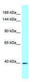Anti-IL6ST antibody produced in rabbit affinity isolated antibody