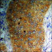 Anti-phospho-PAK4/5/6 (pSer474) antibody produced in rabbit affinity isolated antibody