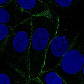 Monoclonal Anti-VANGL1 antibody produced in mouse Prestige Antibodies® Powered by Atlas Antibodies, clone CL0241, purified immunoglobulin, buffered aqueous glycerol solution