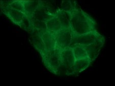 Anti-l/s-Afadin antibody produced in rabbit affinity isolated antibody