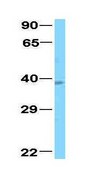 Anti-RORB antibody produced in rabbit affinity isolated antibody