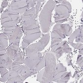 Anti-PDE8B antibody produced in rabbit Prestige Antibodies® Powered by Atlas Antibodies, affinity isolated antibody, buffered aqueous glycerol solution