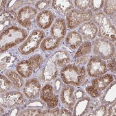 Anti-TNFSF10 antibody produced in rabbit Prestige Antibodies® Powered by Atlas Antibodies, affinity isolated antibody, buffered aqueous glycerol solution