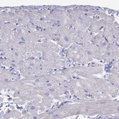 Anti-TNNT3 antibody produced in rabbit Prestige Antibodies® Powered by Atlas Antibodies, affinity isolated antibody, buffered aqueous glycerol solution