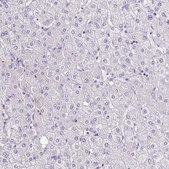 Anti-TNNT2 antibody produced in rabbit Prestige Antibodies® Powered by Atlas Antibodies, affinity isolated antibody, buffered aqueous glycerol solution