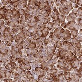 Anti-TBC1D2B antibody produced in rabbit Prestige Antibodies® Powered by Atlas Antibodies, affinity isolated antibody, buffered aqueous glycerol solution