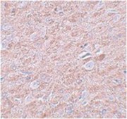 Anti-PRDM16 Antibody from rabbit, purified by affinity chromatography