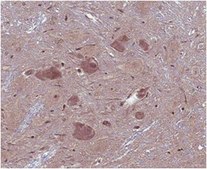 Anti-GABA Antibody from rabbit, purified by affinity chromatography