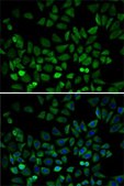 Anti-CDK4 antibody produced in rabbit