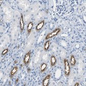 Anti-SLC12A1 antibody produced in rabbit Prestige Antibodies® Powered by Atlas Antibodies, affinity isolated antibody, buffered aqueous glycerol solution
