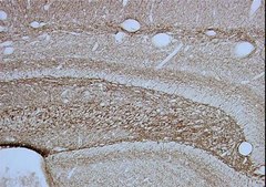 抗神经丝200 kDa抗体，克隆RT97 clone RT97, Chemicon®, from mouse