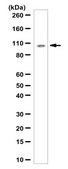 Anti-Prospero homeobox protein 1/PROX1 Antibody from rabbit, purified by affinity chromatography
