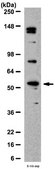 Anti-VPAC1 Antibody from rabbit, purified by affinity chromatography