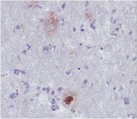 Anti-Amyloid, β 1-40, aβ Antibody from rabbit, purified by affinity chromatography
