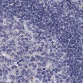 Anti-APOH antibody produced in rabbit Prestige Antibodies® Powered by Atlas Antibodies, affinity isolated antibody, buffered aqueous glycerol solution