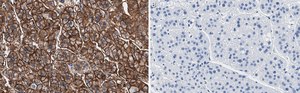 Anti-MDR-1 Antibody, clone 1O12 ZooMAb® Rabbit Monoclonal recombinant, expressed in HEK 293 cells