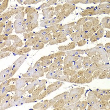 Anti- TTC11/FIS1 antibody produced in rabbit