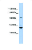 Anti-TRPM8, (N-terminal) antibody produced in rabbit affinity isolated antibody