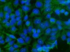 Anti-Rabbit IgG (whole molecule)–FITC antibody produced in goat affinity isolated antibody, buffered aqueous solution