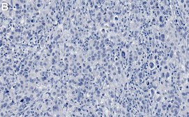 Anti-PTEN Antibody, clone 6H2.1 ZooMAb® Mouse Monoclonal recombinant, expressed in HEK 293 cells