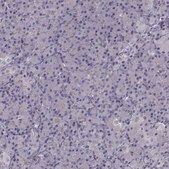 Anti-PRKCE antibody produced in rabbit Prestige Antibodies® Powered by Atlas Antibodies, affinity isolated antibody, buffered aqueous glycerol solution