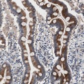 Anti-MUTYH antibody produced in rabbit Prestige Antibodies® Powered by Atlas Antibodies, affinity isolated antibody, buffered aqueous glycerol solution