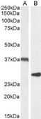 Anti-Uncoupling Protein 2/UCP2 antibody produced in goat affinity isolated antibody, buffered aqueous solution