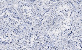 Anti-G3BP1 Antibody, clone 1B10 ZooMAb® Rabbit Monoclonal recombinant, expressed in HEK 293 cells