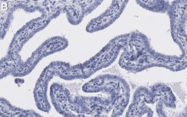 Anti-Progesterone Receptor Antibody, clone 1D2 ZooMAb® Rabbit recombinant, expressed in HEK 293 cells