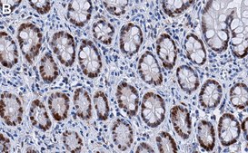 Anti-Vitamin D3 Receptor Antibody, clone 1M19 ZooMAb® Rabbit Monoclonal recombinant, expressed in HEK 293 cells