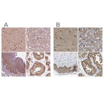 Anti-PSMC5 antibody produced in rabbit Prestige Antibodies® Powered by Atlas Antibodies, affinity isolated antibody