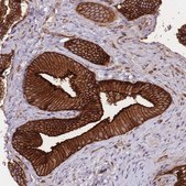 Anti-PLD1 antibody produced in rabbit Prestige Antibodies® Powered by Atlas Antibodies, affinity isolated antibody, buffered aqueous glycerol solution