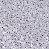 Anti-HMGA1 antibody produced in rabbit Prestige Antibodies® Powered by Atlas Antibodies, affinity isolated antibody, buffered aqueous glycerol solution