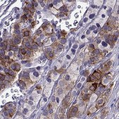 Anti-IGSF1 antibody produced in rabbit Prestige Antibodies® Powered by Atlas Antibodies, affinity isolated antibody