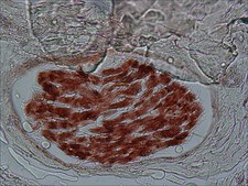 Monoclonal Anti-S-100 (β-Subunit) antibody produced in mouse clone SH-B1, ascites fluid
