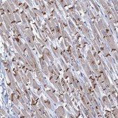 Anti-TMX2 antibody produced in rabbit Prestige Antibodies® Powered by Atlas Antibodies, affinity isolated antibody, buffered aqueous glycerol solution