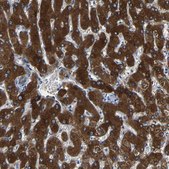 Anti-FTCD antibody produced in rabbit Prestige Antibodies® Powered by Atlas Antibodies, affinity isolated antibody, buffered aqueous glycerol solution