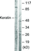 Anti-Keratin 8 antibody produced in rabbit affinity isolated antibody