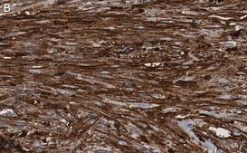 Anti-β-Actin Antibody, clone 6L12, ZooMAb® Rabbit Monoclonal recombinant, expressed in HEK 293 cells