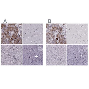 Anti-PNMT antibody produced in rabbit Prestige Antibodies® Powered by Atlas Antibodies, affinity isolated antibody, buffered aqueous glycerol solution