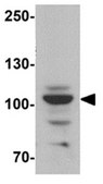 Anti-EPAC1 Antibody from rabbit, purified by affinity chromatography