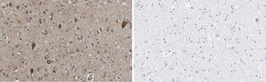 Anti-VGLUT2 Antibody, clone 8G9.2 ZooMAb® Mouse Monoclonal recombinant, expressed in HEK 293 cells