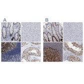 Anti-PCNA antibody produced in rabbit Prestige Antibodies® Powered by Atlas Antibodies, affinity isolated antibody, buffered aqueous glycerol solution, ab1