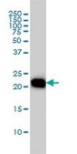 Monoclonal Anti-RHOA antibody produced in mouse clone 1B12, purified immunoglobulin, buffered aqueous solution