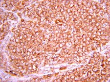 抗缺氧诱导因子1 α 抗体，克隆 H1α67 clone H1alpha67, Chemicon®, from mouse