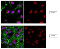 抗 RNF168 抗体 from rabbit, purified by affinity chromatography