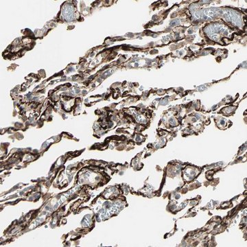 Anti-CALCRL antibody produced in rabbit Prestige Antibodies® Powered by Atlas Antibodies, affinity isolated antibody, buffered aqueous glycerol solution